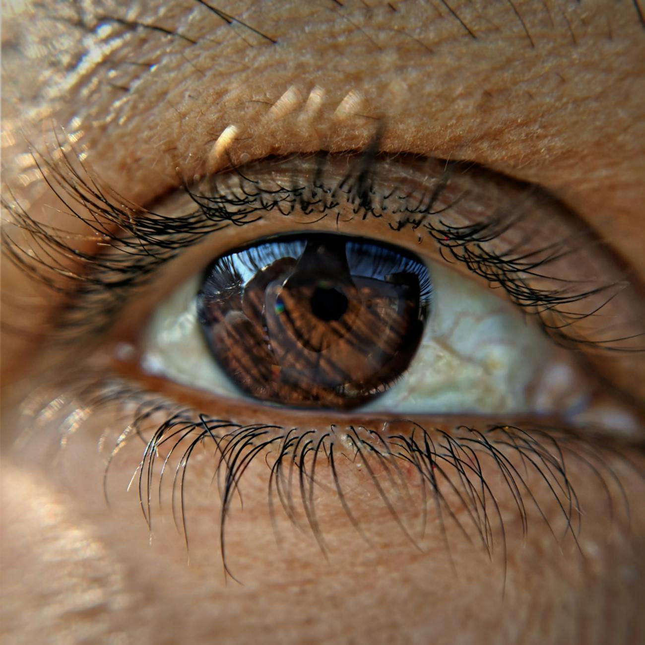 Deep Learning Models for Skin Lesion Analysis