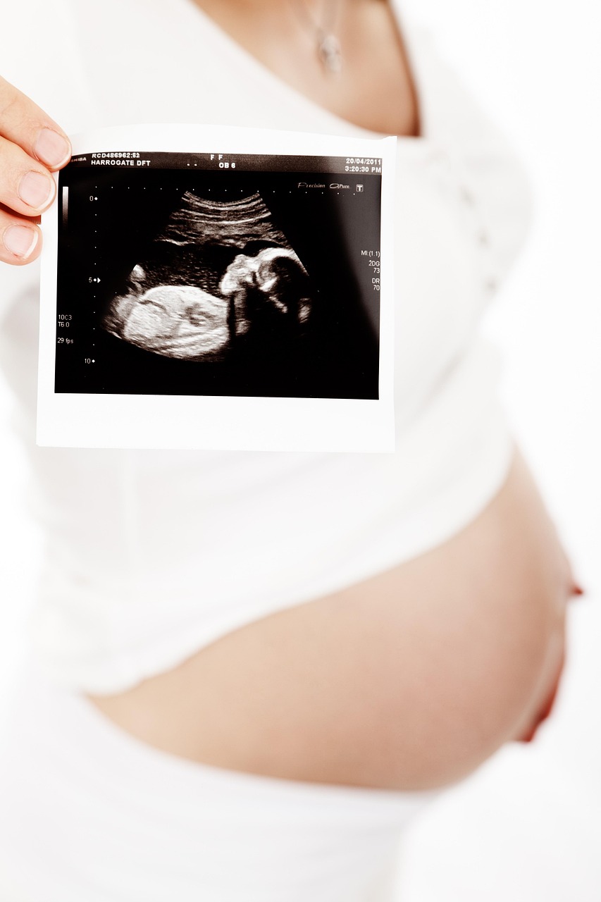 Advanced Doppler Ultrasound in Obstetrics and Gynecology