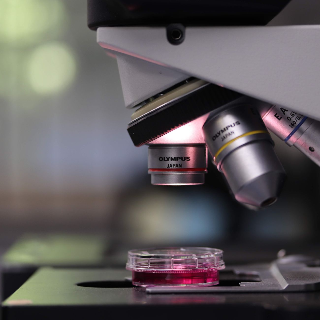 Clinical Trials and Research in NMOSD Treatment