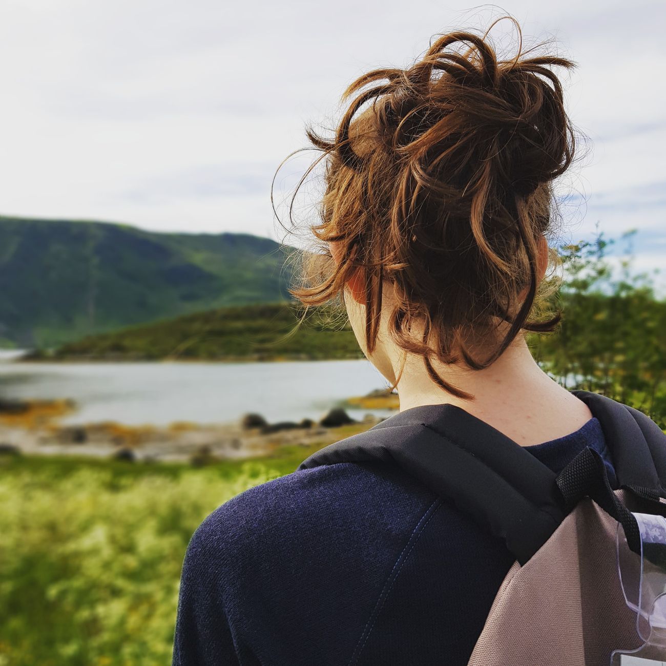 Introduction to Nutritional Solutions for Hair Loss